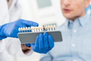 Affordable Dental implants Perth